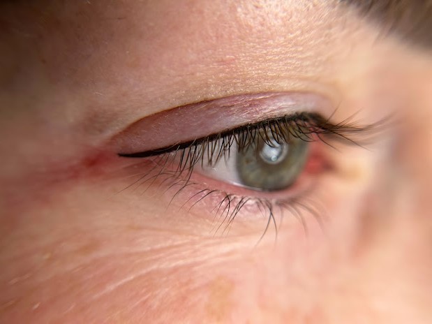 Permanent Eyeliner Result